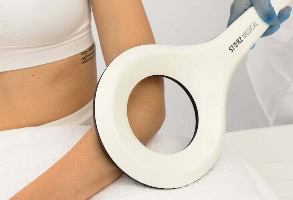 EMTT therapy for tennis elbow.