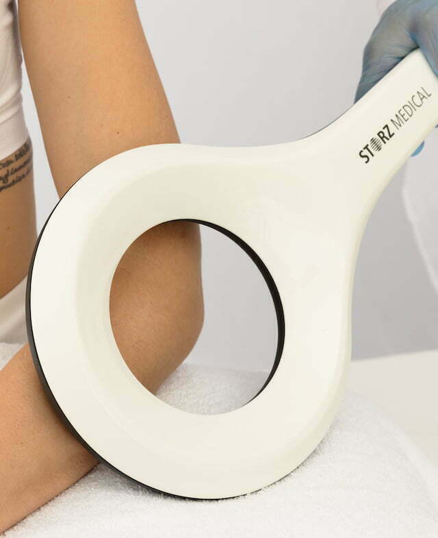 EMTT Tennis Elbow Treatment