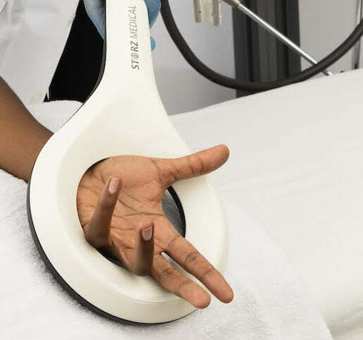 Dupuytren's Disease EMTT Treatment.