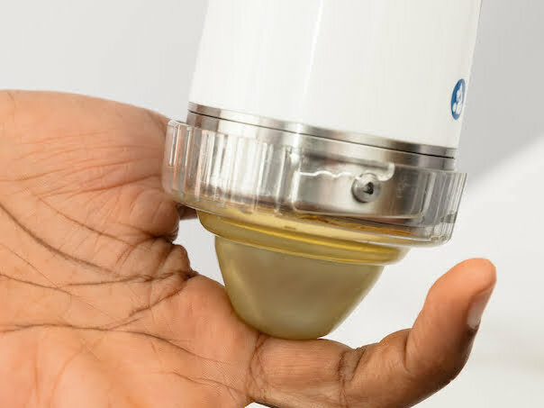 Dupuytren's Disease Shockwave Treatment.