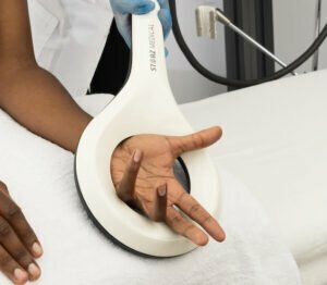 EMTT therapy for carpal tunnel syndrome.