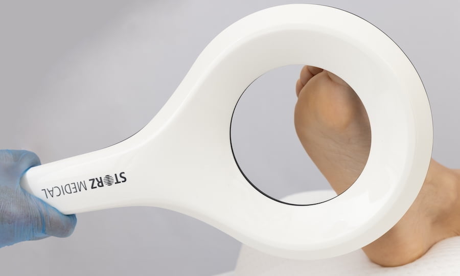 Morton's Neuroma Treatment.