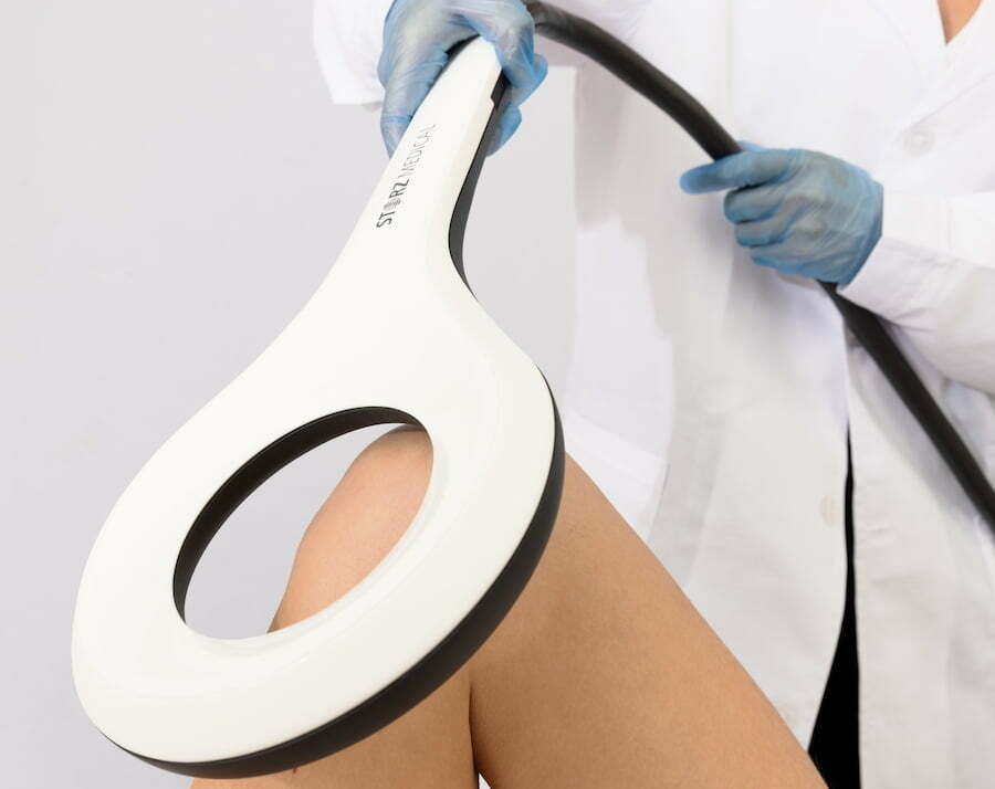 Patellar Tendinitis Treatment.